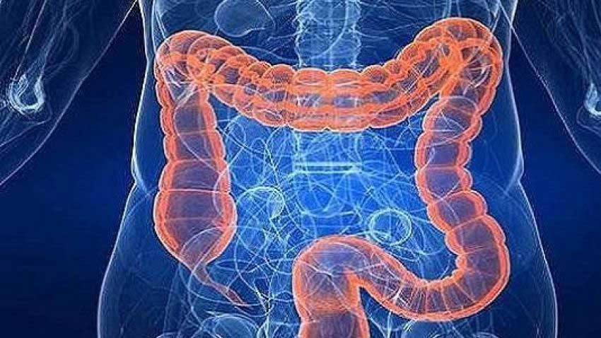 نقش پروبیوتیک ها در درمان سرطان روده