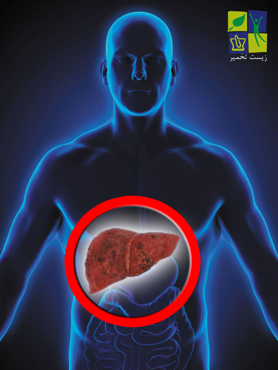 نقش پروبیوتیک ها بر بیماری کبد چرب