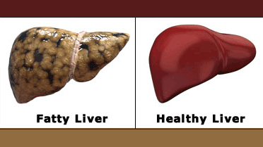 مقابله پروبیوتیک ها با کبد چرب