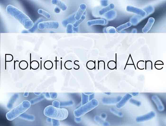 Probiotics and Acne