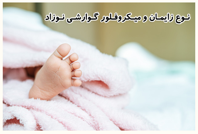 نوع زایمان بر میکروبیوم روده نوزادان تاثیرگذار است!