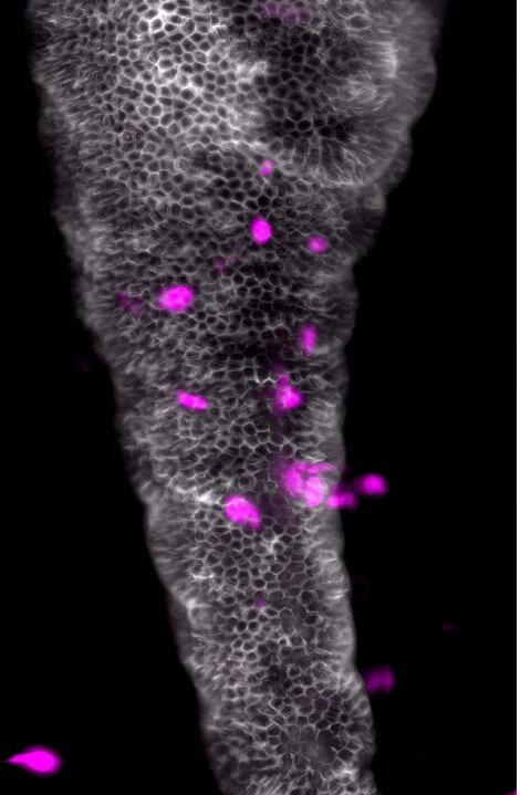 چگونه میکروبیوتا فعالیت نوتروفیل ها را کنترل می کند؟