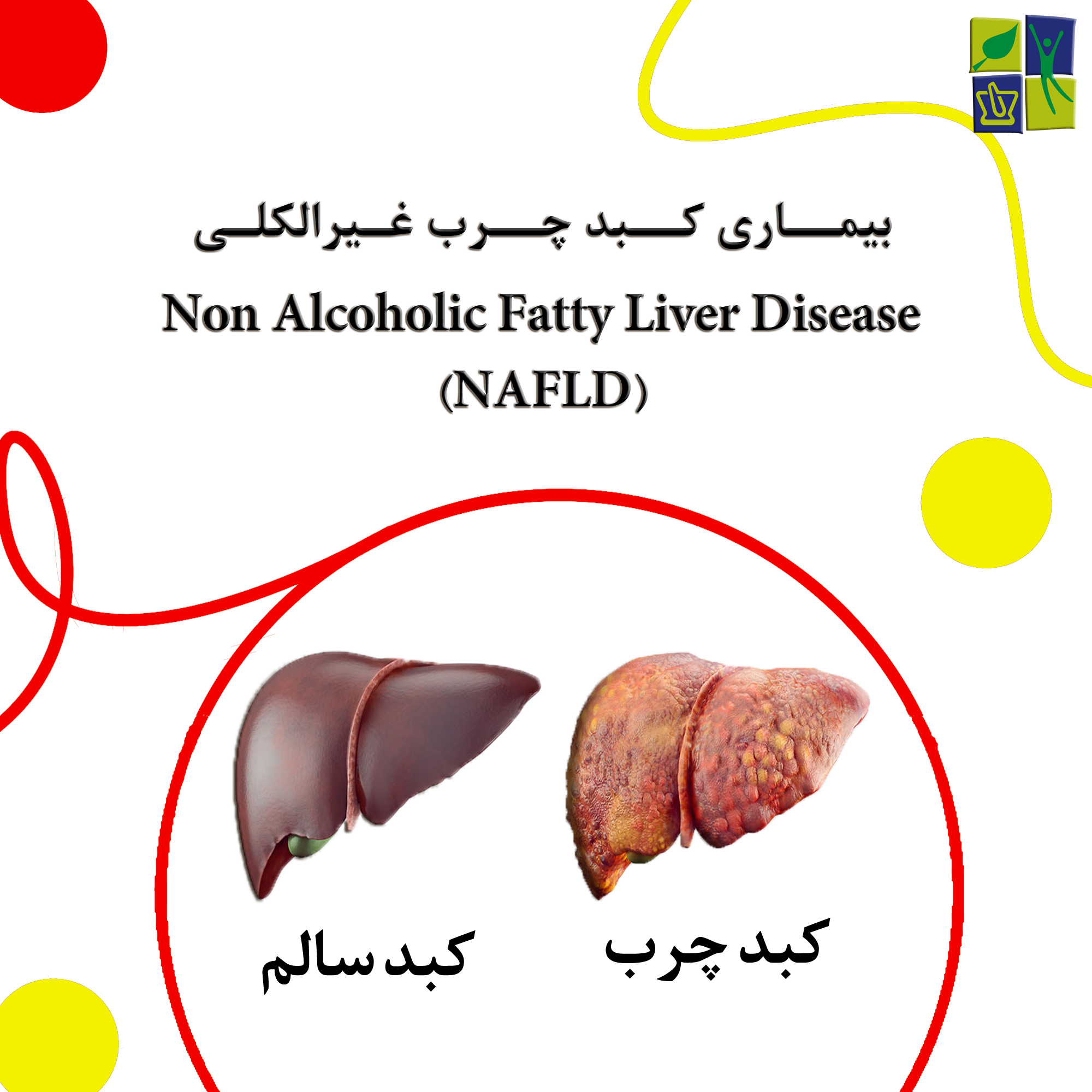 بیماری کبد چرب غیرالکلی چیست؟